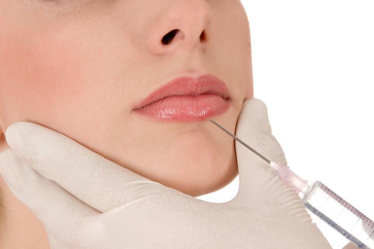 laser treatment for rosacea