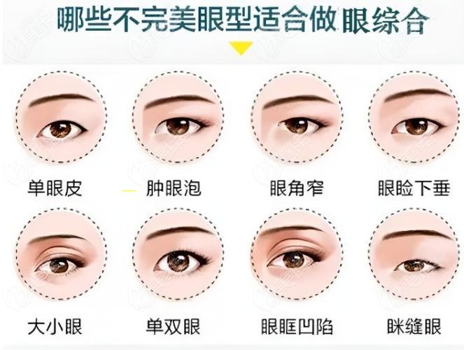 实测：以上海星采双眼皮修复取得了惊人效果！