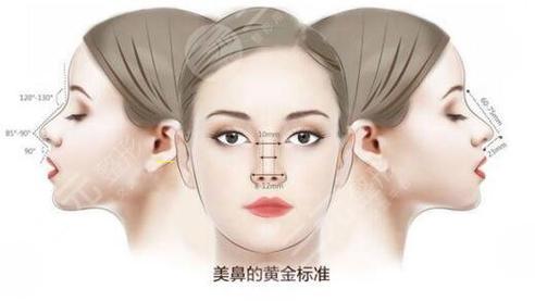 维纳斯玻尿酸(venus维纳斯*代理)