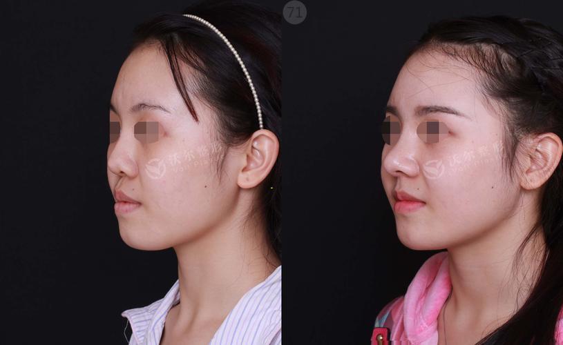 女性在使用脱毛膏以除去腋毛