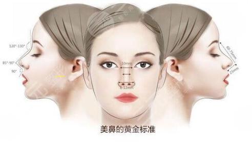 韩式隆鼻对比,韩式隆鼻术手术介绍及特点